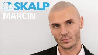 Baldness solution  Marcin explains Scalp Micropigmentation at Skalp® [upl. by Nove39]