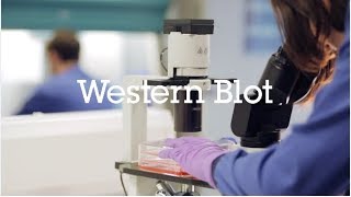 Western blot protocol video [upl. by Lorne]