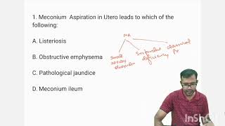 Neonatology MCQTopic 1 MECONIUM ASPIRATION SYNDROME mcq newborn education neet [upl. by Biamonte]