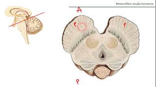 ANATOMIA DO MESENCÉFALO [upl. by Brawley]