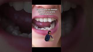 No la embarres please cuidadodental entrevista dentista tips [upl. by Moshell326]