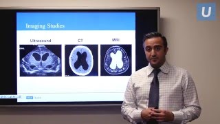 Management of Pediatric Hydrocephalus  Aria Fallah MD  UCLAMDChat [upl. by Adil89]