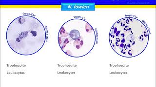 Naegleria fowleri [upl. by Nhor]