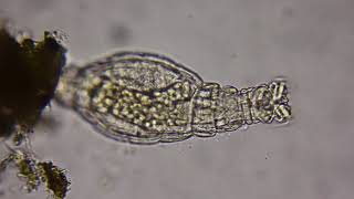 Rotifer under a microscope [upl. by Sharity]