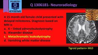 Metachromatic leukodystrophy Tigroid pattern [upl. by Cirtap]