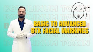 Basic to Advanced Botulinum Toxin Facial Markings  Dr Ajay Rana [upl. by Raimundo]