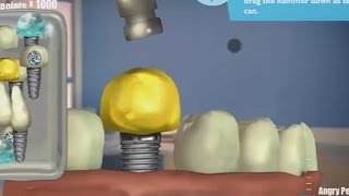 GLEMM MARTINDDS  DENTAL ADVENTURE DENTAL SURGERY 4 [upl. by Enirol]