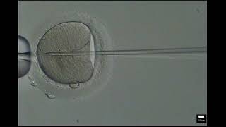 ICSI embryo  SRM Embryology Lab video [upl. by Shandee180]