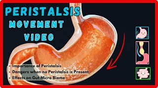 WHAT WILL HAPPEN IF PERISTALSIS ACTION IN DIGESTION STOPS [upl. by Labina39]