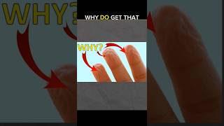 Why Do get that finger wrinkles 😱 viralshort knowledge amazingfacts shortsfeed [upl. by Calvano]