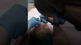 Watch the transformation after dental bonding shorts [upl. by Orest584]