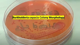 Burkholderia cepacia growth on Macconkey agar [upl. by Noicpecnoc]