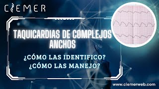 Taquicardias ventriculares de complejos anchos Como las identifico y como las manejo [upl. by Akinuahs]