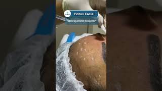 Botox Facial na CR Laser® [upl. by Irisa760]