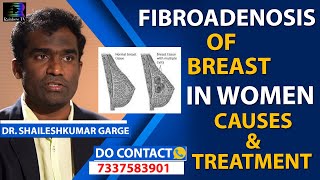 Fibroadenoma of Breast in Women Causes amp New Treatment in Telugu  Citi Vascular Centre [upl. by Sairtemed]