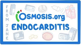 Clinicians Corner Endocarditis [upl. by Duong249]