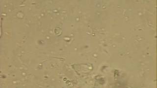 Giardia Trophozoite Looped [upl. by Harts]