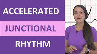 Accelerated Junctional Rhythm ECG Nursing EKG NCLEX Review Made Easy [upl. by Senecal739]