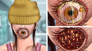 ASMR Remove the Parasitic Giant Eye amp Maggots on the mouth  Deep Cleaning Animation [upl. by Delanty]