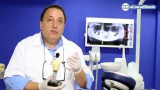 Clinique Dentaire Internationale Casablanca § Dr Jalil BERRADA Implants dentaires [upl. by Colt]