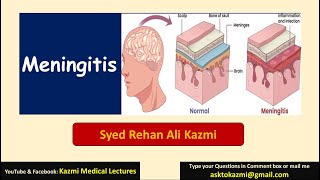 Meningitis  Neurology  Pediatric Review  KML [upl. by Riatsila]