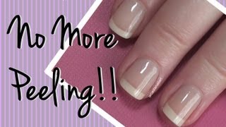 How I Fixed My Peeling Nails Nail Care Video by ArcadiaNailArt [upl. by Eillah979]