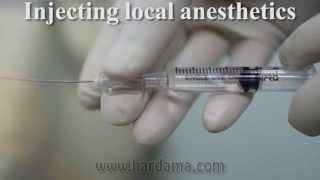 Spinal anesthesia [upl. by Eanar]