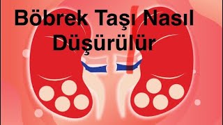 Böbrek Taşım Var Nasıl Düşürebilirim [upl. by Einnos]