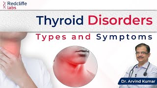 What are Thyroid Disorders जानें Thyroid के लक्षण कारण और इलाज के बारे में  Dr Arvind Kumar [upl. by Grevera546]