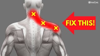 How to INSTANTLY Fix Pinched Nerve Pain in the Neck and Shoulders [upl. by Chasse]