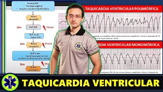 Taquicardia Ventricular no APH  O Que Fazer [upl. by Kcirdes]