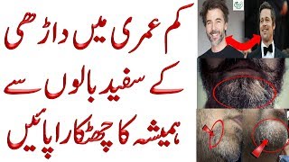 Safed Balo Ko Kala Karne Ka Ilaj  White Hair Problem In Teenage  Grey Hair Beard Home Remedies [upl. by Ientirb406]