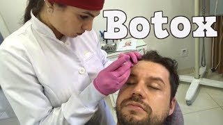 Aplicação de Botox  Toxina Botulínica  mostrando o que uso [upl. by Hasila88]