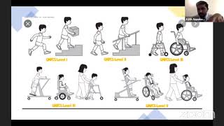 Cerebral Palsy for the FRCS Orth [upl. by Soluk694]