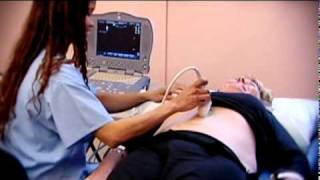 Abdominal Aortic Aneurysm  Health Screening  Life Line Screening [upl. by Wandie]