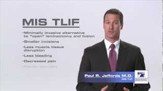 MIS TLIF  Minimally Invasive Surgical Transforaminal Lumbar Interbody Fusion [upl. by Buskus]