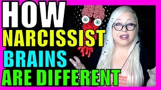 Narcissists Brains Are Different Than Yours Heres How and What It Means [upl. by Ecirtram]