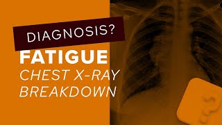 How to Interpret a Chest XRay Lesson 5  Cardiac Silhouette and Mediastinum [upl. by Enailuj]