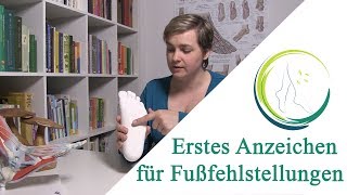 Erstes Anzeichen für Fußfehlstellungen [upl. by Gamal]