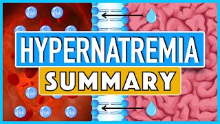 Hypernatremia Summary [upl. by Apollus]