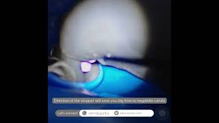 Lower first premolar with 3 canals  Unusual root canal anatomy [upl. by Michelle858]