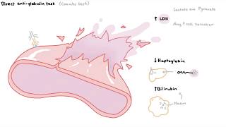 How to diagnose haemolytic anaemia [upl. by Gaylord103]