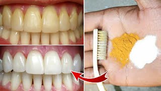 Magical Teeth Whitening home Remedy Get whiten Teeth at home in 3 minutes [upl. by Zwiebel]