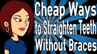 Cheap Ways to Straighten Teeth Without Braces [upl. by Devin]