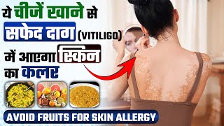 सफेद दाग के मरीज को नाश्ते में क्या क्या खाना चाहिए  Full Day Diet Plan for Vitiligo सफ़ेद दाग [upl. by Faso]