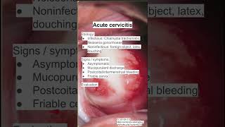 Acute cervicitis [upl. by Annayi]