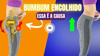 EMPINE O BUMBUM COM UMA SIMPLES CORREÇÃO POSTURAL [upl. by Gavan]