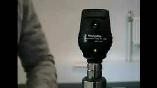 Fundoscopy 2  Equipment  Ophthalmoscope [upl. by Nnaycart200]