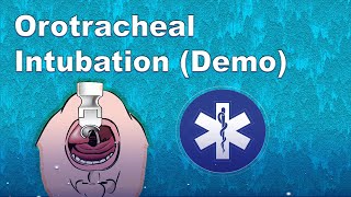 Laryngoscope InUse Online Visual Demo [upl. by Omissam697]