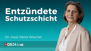 Schleimhautentzündungen  Ein Hinweis auf stille Entzündungen  Dr med Petra Wiechel  QS24 [upl. by Uaerraj]